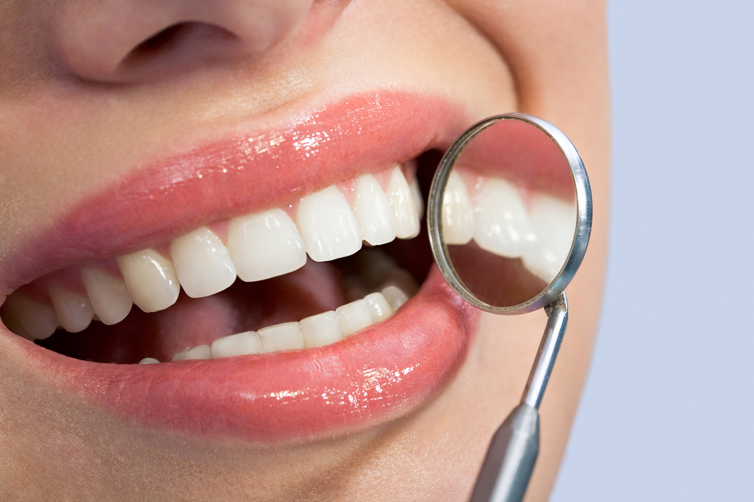 a woman getting her teeth checked for plaque