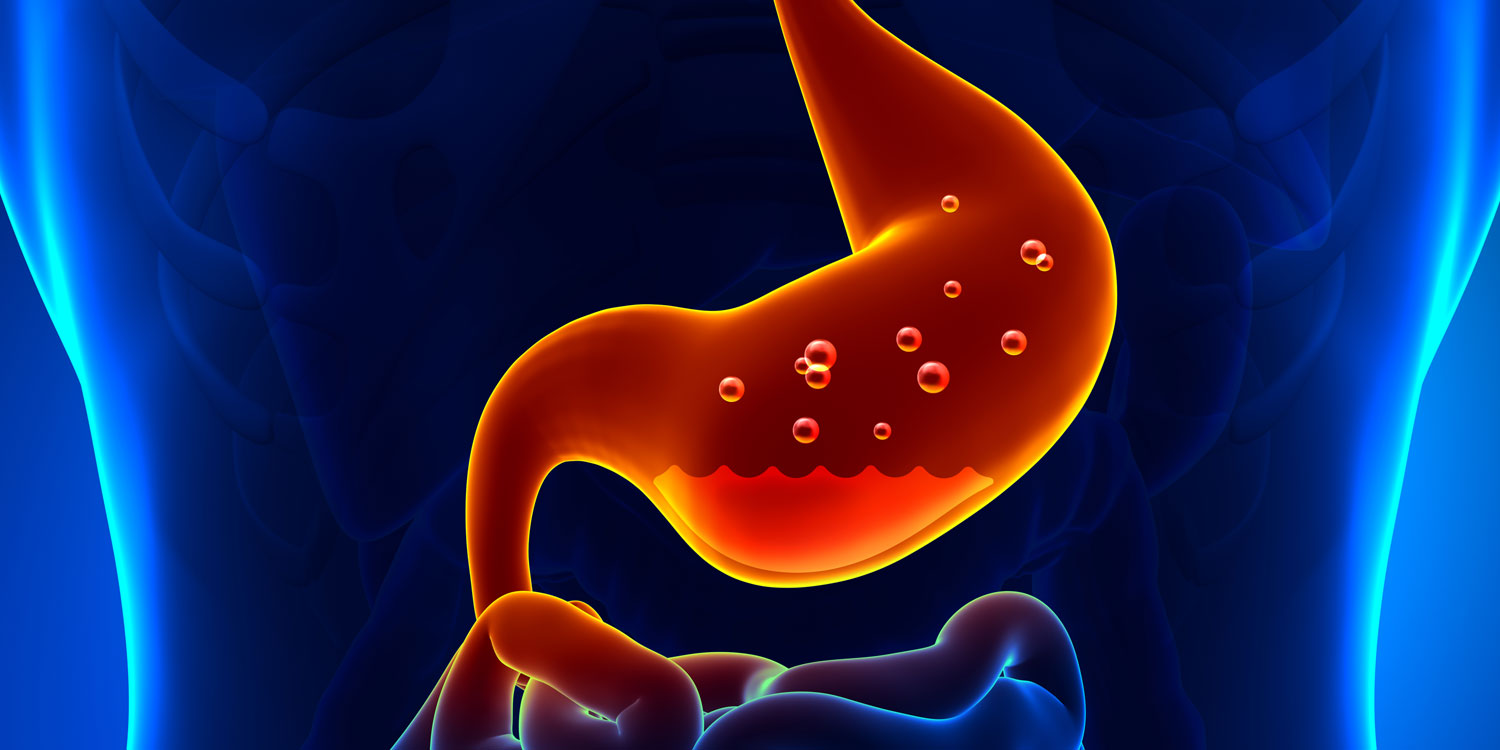 acid reflux, heartburn, indigestion