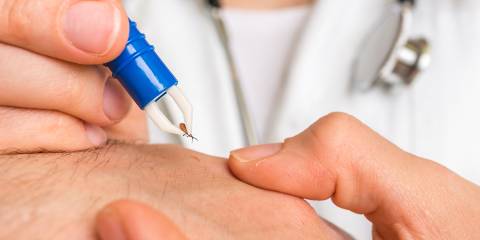 A doctor carefully tweezing a tick off of her patient