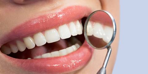 a woman getting her teeth checked for plaque