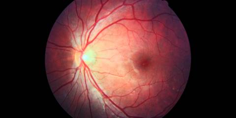 a photo of inside of the human eye